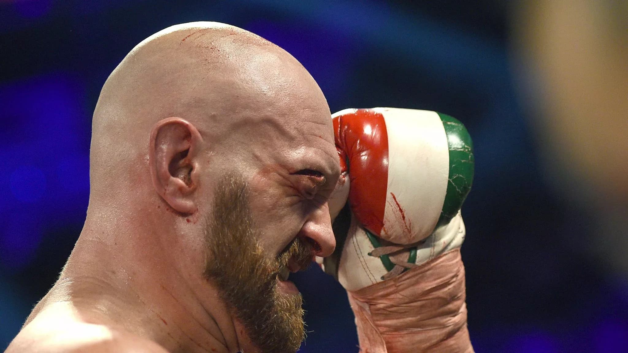 Usyk Warns Fury Over His Cut – ‘My Strategy Is To Win'