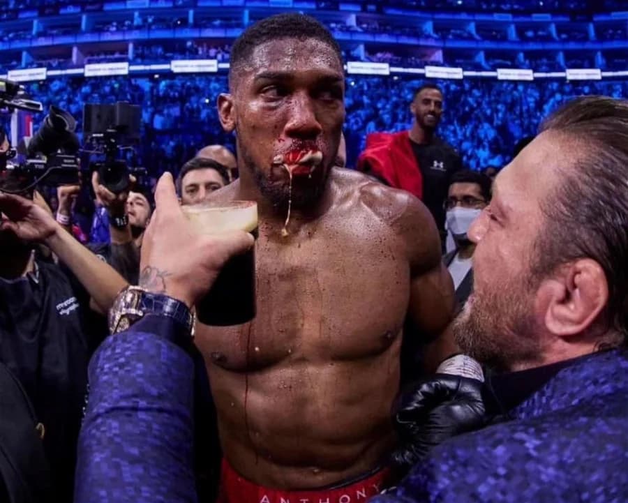 Anthony Joshua Admires Conor McGregor – ‘He's Someone You Can Take Inspiration From'