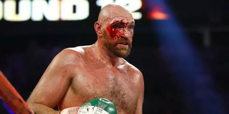 Fury’s Cut Gives Him Problems Against Usyk – ‘It’s Going To Be A Bloodbath'