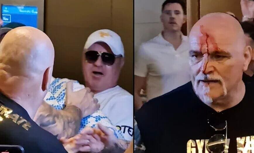John Fury Left Bleeding After Headbutting Team Usyk