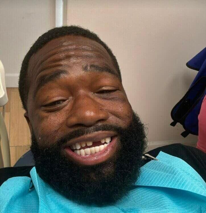 Adrien Broner Checks Into A Dentist With Missing Teeth – ‘He Looks 60, Time To Retire'