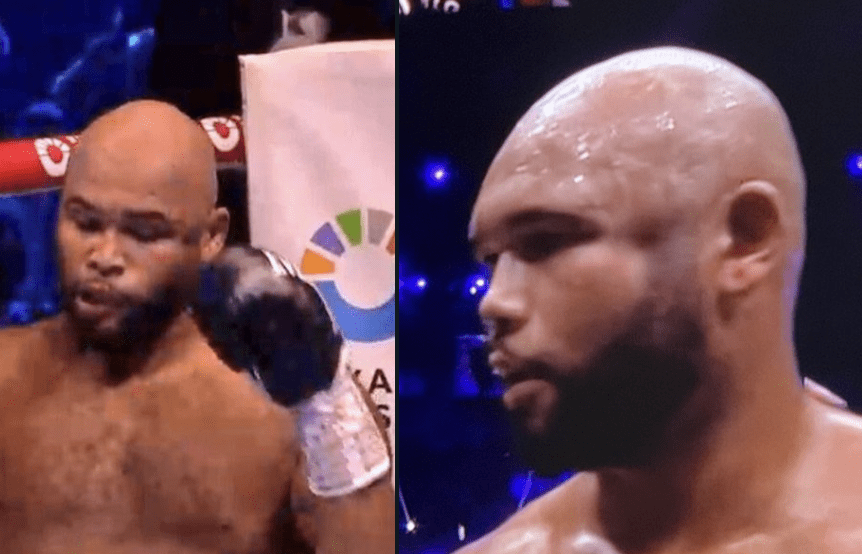 Frazer Clarke Has Surgery After Wardley KO