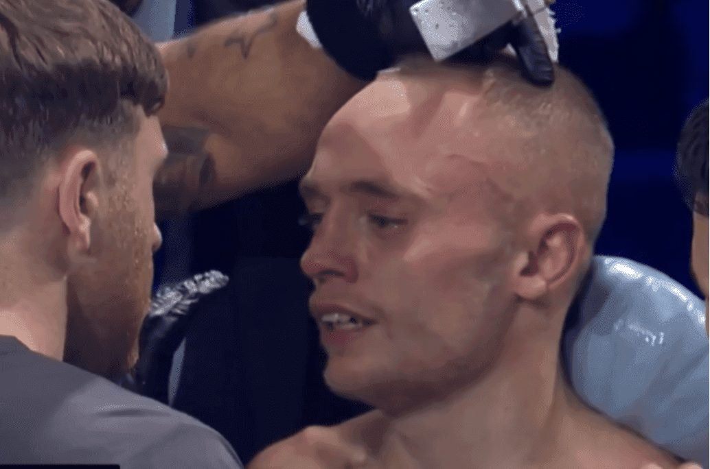 Edwards’ Corner Slammed After Yafai Loss – ‘They Have A Duty Of Care'