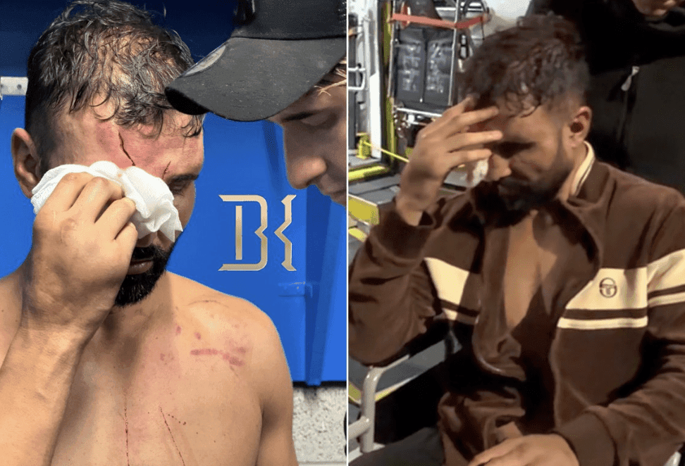 Paulie Malignaggi's Latest Comments Worry Fans – ‘Why Is He Doing This?'