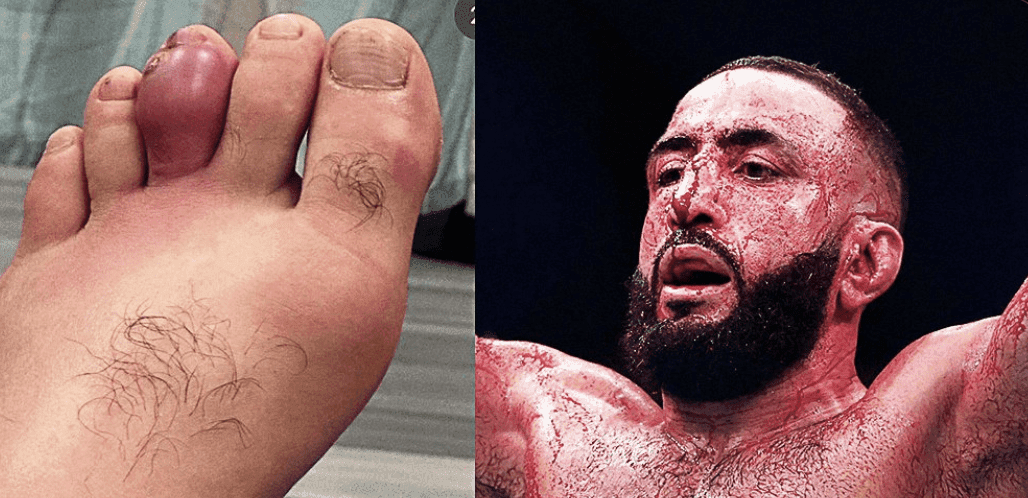 Belal Calls McGregor A ‘Junkie' For Mocking His UFC 310 Withdrawal