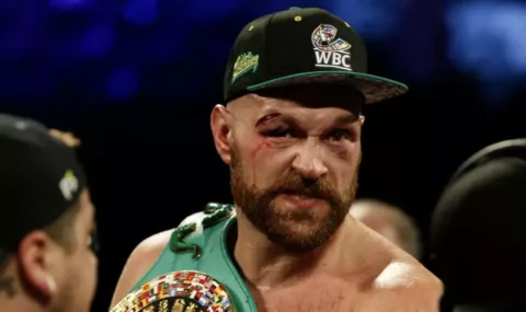 Fury Is No Longer The Same - 'He Had 47 Stitches'
