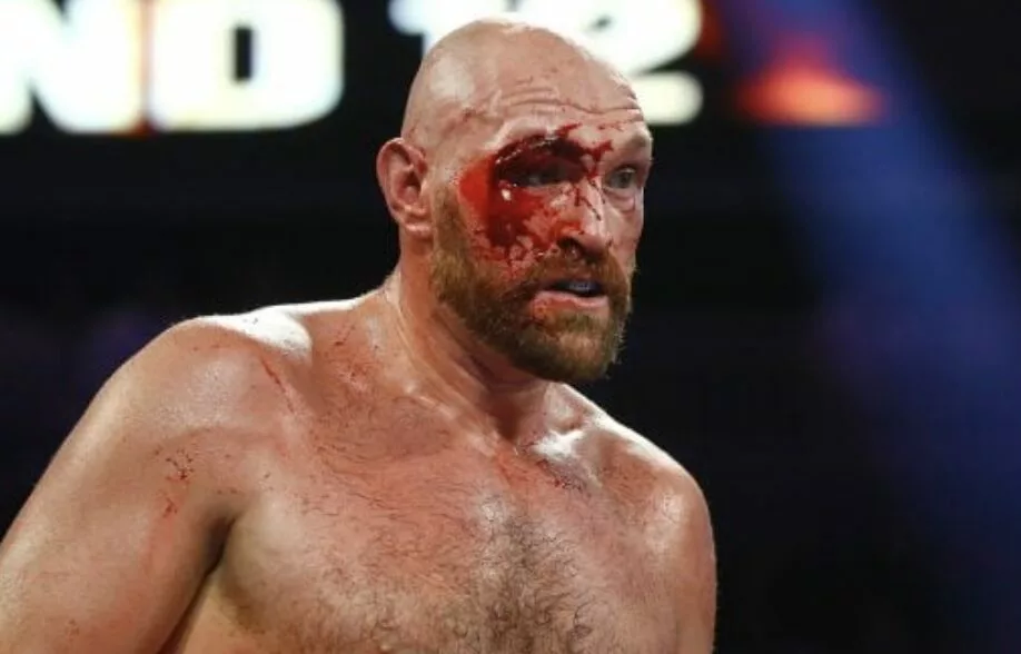 Fury's Cut Has Not Healed - 'It Is Going To Take Double The Time To Heal, It Will Open'