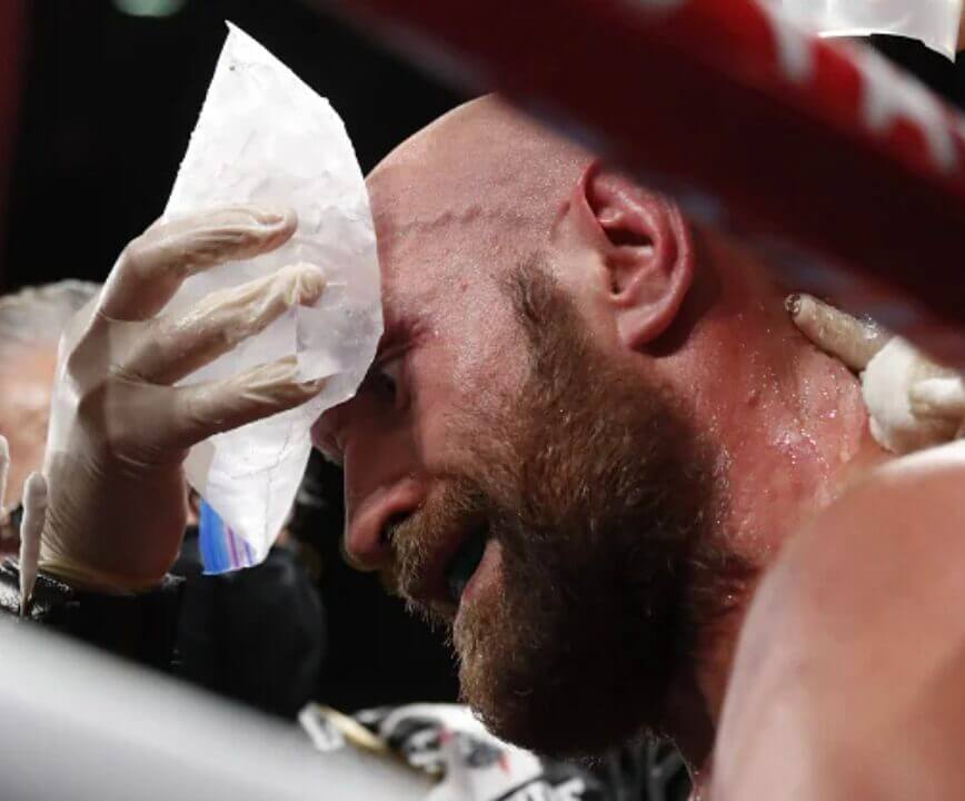 Krassyuk Warns Fury Not To Pull Out - 'Let’s Pray For Tyson'