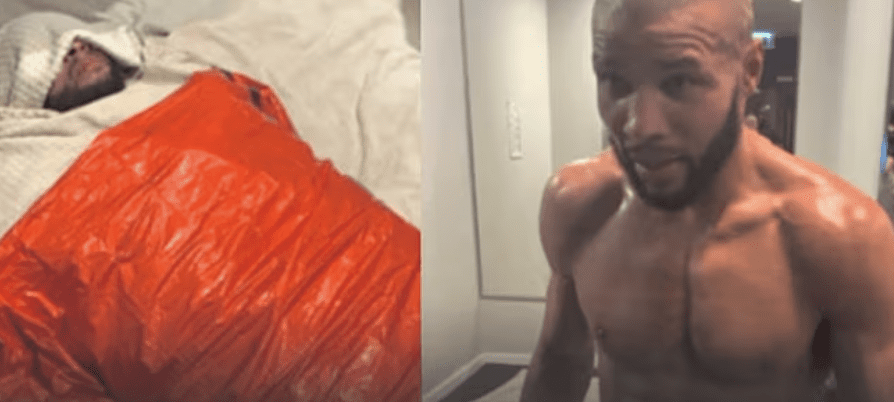 Eubank And Benn Weigh-In Controversy - 'They Had An Agenda'